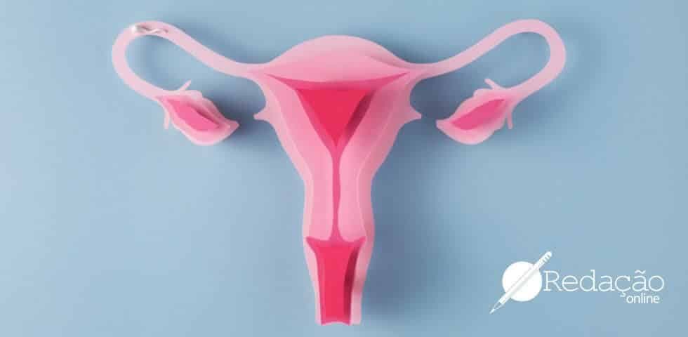 endometriose-anitta-doença