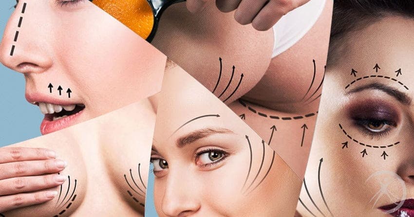 várias cirurgias plásticas