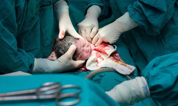 parto normal ou cesárea